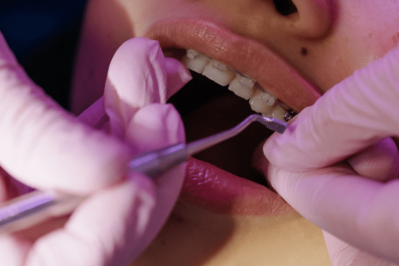 Orthodontic Dental Assistant - Brooklyn image