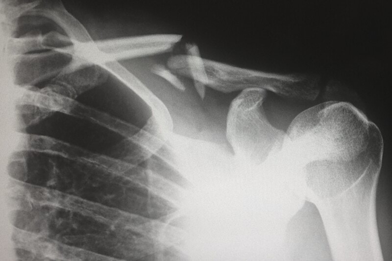 Specialistsjuksköterska till röntgenavdelning Örnsköldsvik image
