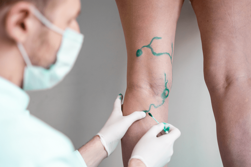 ANGIOLOGIA Y CIRUGIA VASCULAR CONSULTA – VALDEMORO, MADRID image