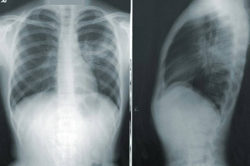 Röntgensköterskor sökes inom radiologi image