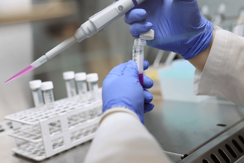 Prácticas en laboratorio: Optimización de Procesos de Esterilización image