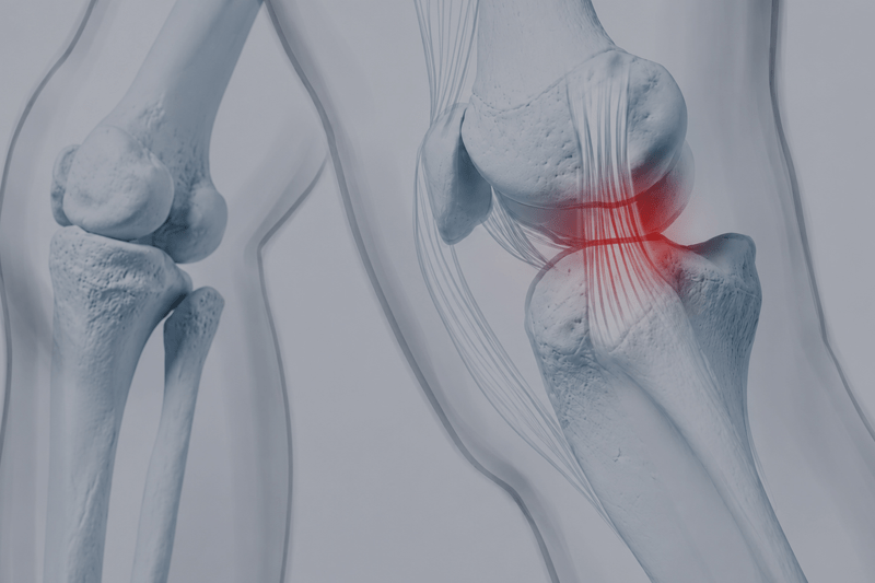 Consultant of Interventional Radiology & Pain Management image