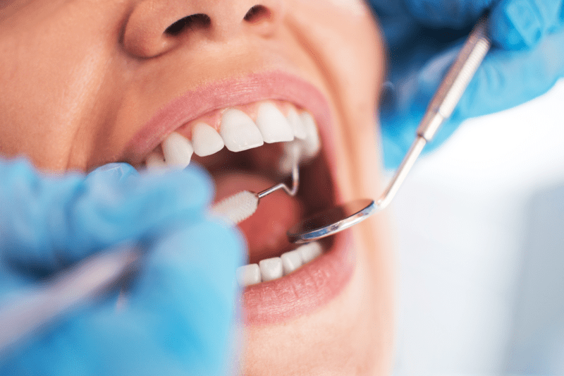 Tandhygienist till STHLM Dental image