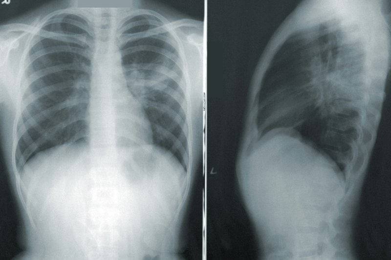 Radiology Tech image