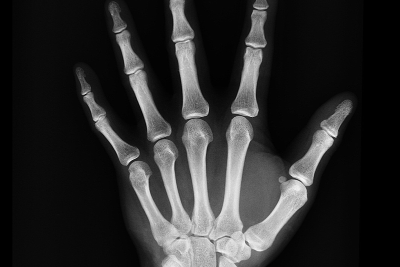 Röntgensjuksköterskor sökes till uppdrag på röntgenavdelning image