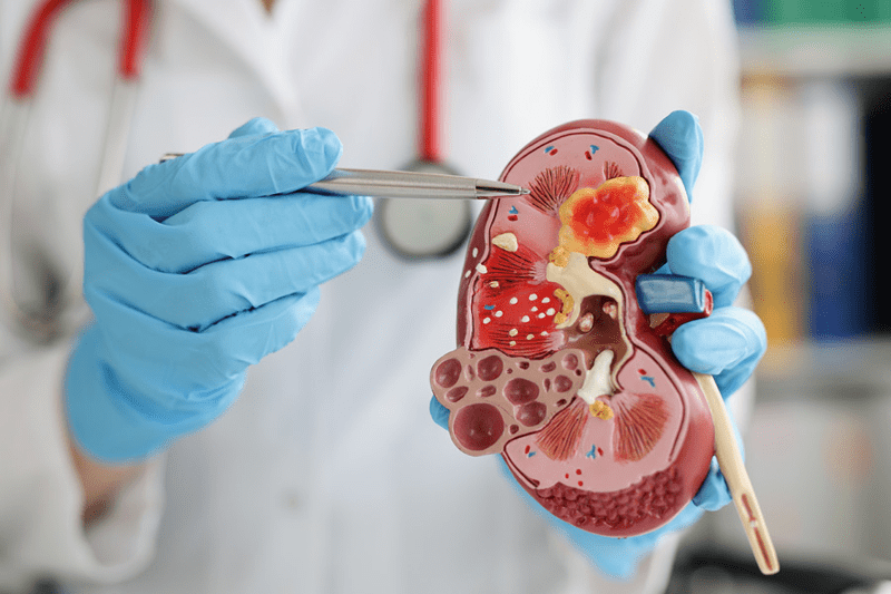 NEFROLOGIA - HOSPITAL PRIVADO ELCHE, ALICANTE image